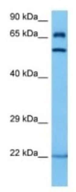 Glucose 6 Phosphate 1-Dehydrogenase 2 Rabbit anti-Mouse, Polyclonal, Novus Biologicals 100 &mu;g | Buy Online | Novus Biologicals | Fisher Scientific